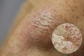 DSLR - Elbow - Macro Room Lighting - A