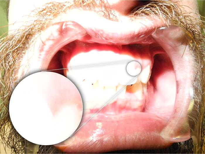 DSLR - Oral Frontal - Macro External Lighting - B