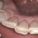 Flexicam: Dental 2