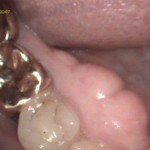 Flexicam: Dental 3