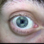 Patient Exam Cameras - AMD 2500 - Eye 02