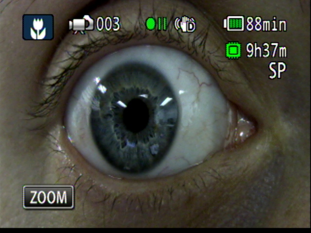 Patient Exam Cameras - Canon HF-M31 - Eye 01