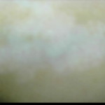 Patient Exam Cameras - GE Home Monitor - Vitiligo