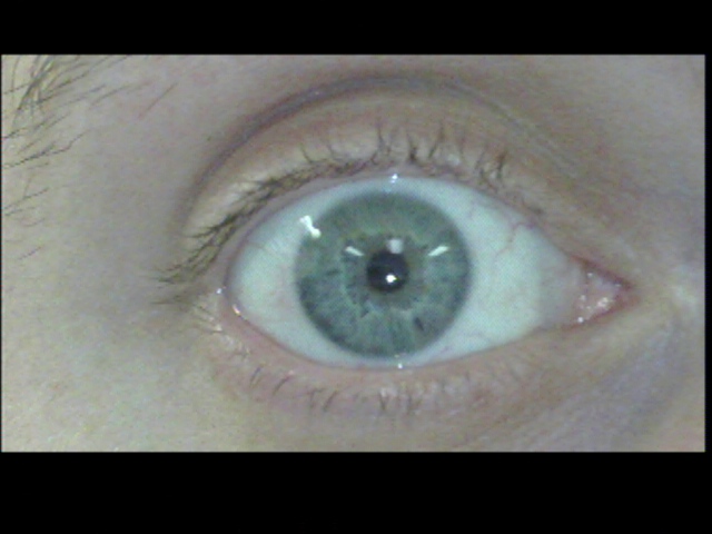 Patient Exam Cameras - Insignia NS-DV720P - Eye 02