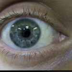 Patient Exam Cameras - Sony DCR-HC40 - Eye 01