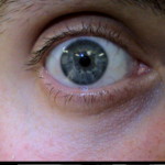 Patient Exam Cameras - Sony DCR-TRV38 - Eye 01