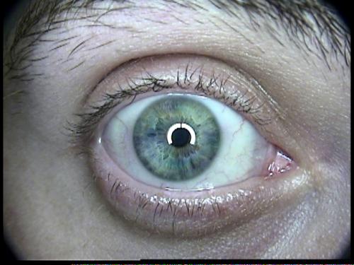 Patient Exam Cameras - AMD 2500 - Eye 01