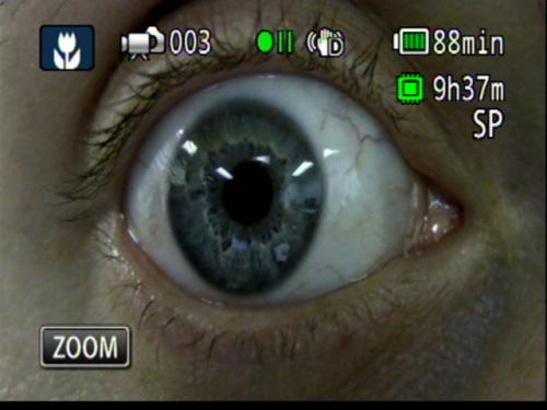 Patient Exam Cameras - Canon HF-M31 - Eye 02