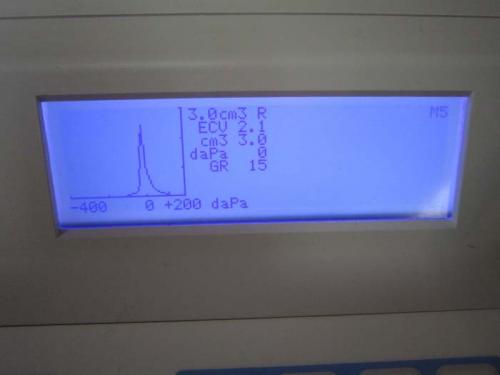 Tympanometers - GSI 39 Auto Tymp - Screen Graph