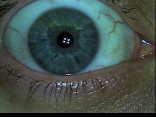 Patient Exam Cameras - GlobalMedia TotalExam (S-Video) - Eye 02