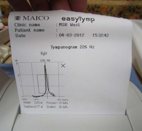 Tympanometers - easyTymp - Printout - A
